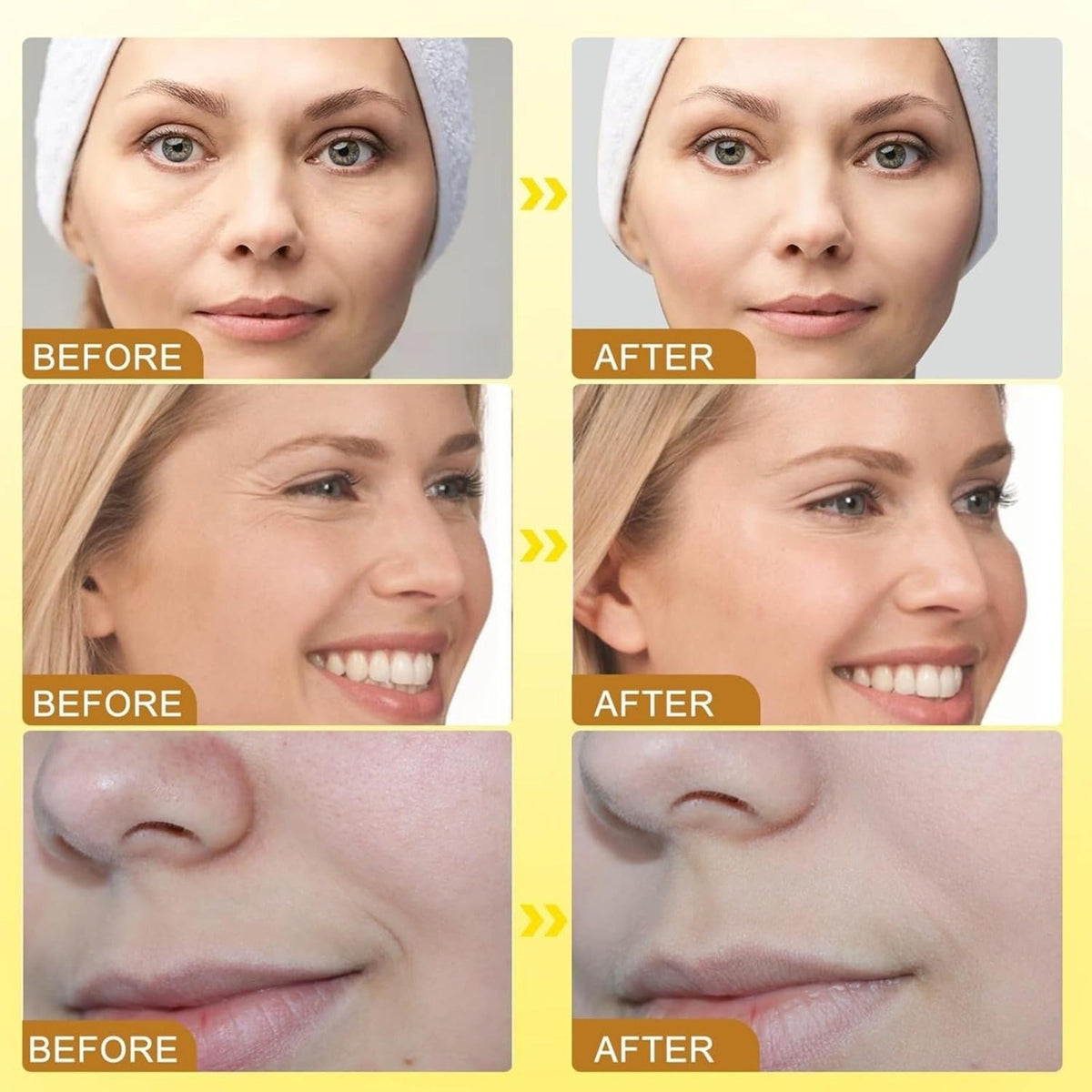 Botox Bee Venom Wrinkle Cream