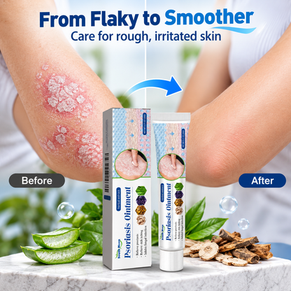 Psoriasis Ointments Sensitive Skin Soothing Care Cream