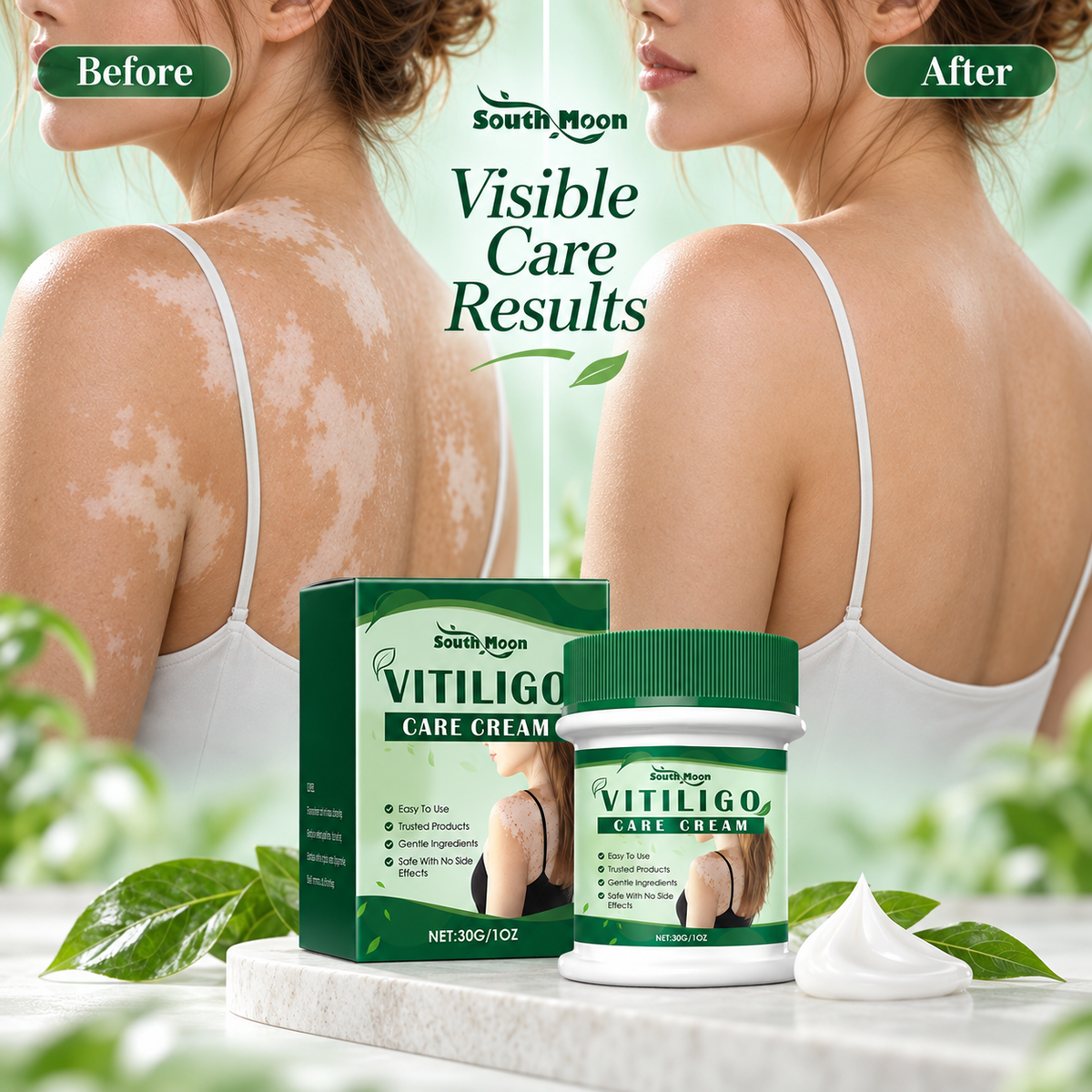 Vitiligo Herbal Aloe Vera & Mint Care Cream