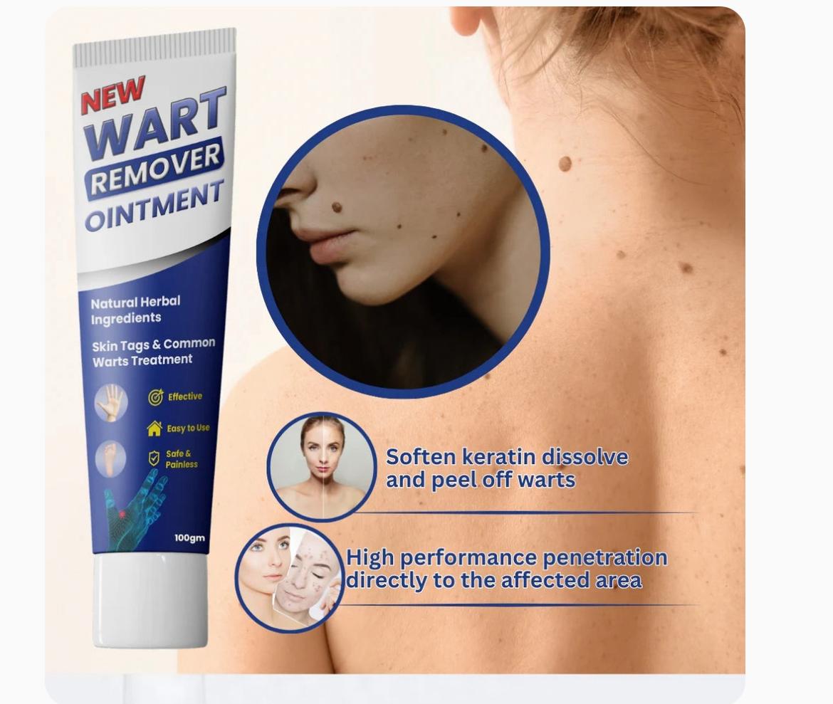 Wart Remover Cream
