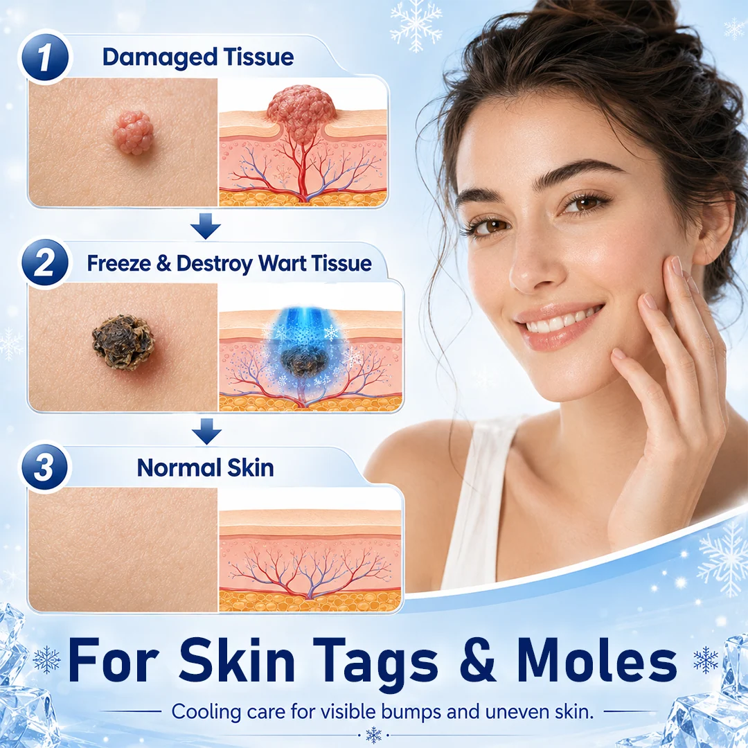 CryoClear Pro Bump Renewal Spray