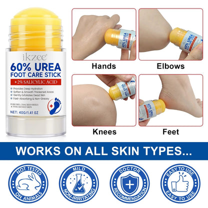 IKZEE 60% Urea Foot Care Stick