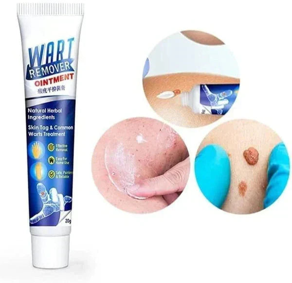 Wart Remover Cream